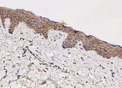 Immunohistochemistry-Paraffin: beta-Catenin Antibody (021) [NBP2-89875] - Staining of human CTNNB1 in human skin with rabbit monoclonal antibody (1:200).
