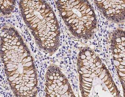 Immunohistochemistry-Paraffin: beta-Catenin Antibody (021) [NBP2-89875] - Staining of human CTNNB1 in human colon with rabbit monoclonal antibody (1:200).