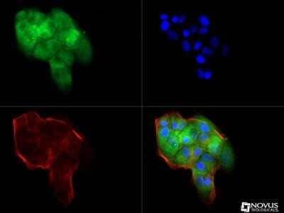 Immunocytochemistry/Immunofluorescence: beta-Catenin Antibody (12F7) - Azide and BSA Free [NBP2-80596] - The beta- Catenin antibody was tested in MCF-7 cells against Dylight 488 (Green). Actin and nuclei were counterstained against Phalloidin 550 (Red) and DAPI (Blue). Image from the standard format of this antibody.