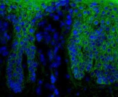 Immunohistochemistry: beta-Catenin Antibody (12F7) - Azide and BSA Free [NBP2-80596] - Beta-catening (green) was detected in human skin (psoriasis) using beta-catenin-FITC antibody (1:40) in PBS for 1 hour. Nuclei were stained with Dapi (blue). Image from verified customer review. Image using the FITC format of this antibody. Image from the