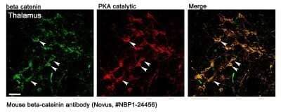 Immunohistochemistry: beta-Catenin Antibody (12F7) - Azide and BSA Free [NBP2-80596] - IF beta-Catenin staining of mouse brain tissue. This image submitted by a verified customer review. Image from the standard format of this antibody.