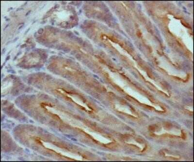 Immunohistochemistry: beta-Catenin Antibody (12F7) - Azide and BSA Free [NBP2-80596] - Analysis of beta Catenin in mouse intestine using DAB with hematoxylin counterstain. Image from the standard format of this antibody.