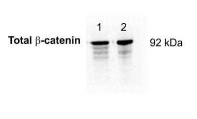 Western Blot: beta-Catenin Antibody (12F7) - Azide and BSA Free [NBP2-80596] - Analysis of beta- Catenin in embryonic lung (lane 1) and embryonic limb (lane 2) lysates using anti-beta- Catenin antibody. Each lane was loaded with 5ug of protein sample. Image from verified customer review. Image from the standard format of this antibody.