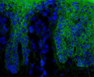 Immunohistochemistry-Frozen: beta-Catenin Antibody (12F7) [FITC] [NBP1-54467F] - Beta-catening (green) was detected in human skin (psoriasis) using beta-catenin-FITC antibody (1:40) in PBS for 1 hour. Nuclei were stained with Dapi (blue). Image from verified customer review.