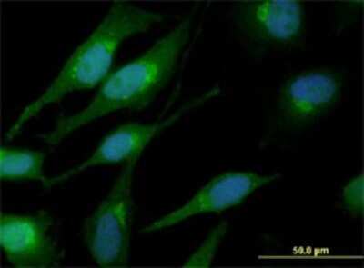 Immunocytochemistry/Immunofluorescence: beta-Catenin Antibody (1C9) [H00001499-M02] - Analysis of monoclonal antibody to CTNNB1 on HeLa cell. Antibody concentration 10 ug/ml.