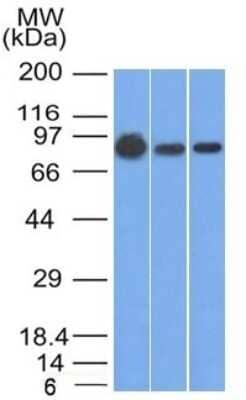 Western Blot: beta-Catenin Antibody (9F2) - Azide and BSA Free [NBP2-54495] - Western Blot of A431, A549 and MCF-7 cell lysates using beta-Catenin Antibody (9F2)