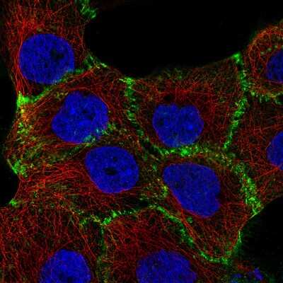 Immunocytochemistry/Immunofluorescence: beta-Catenin Antibody (CL3689) [NBP2-61628] - Staining of A-431 cells using the Anti-CTNNB1 monoclonal antibody, showing specific staining in the plasma membrane in green. Microtubule- and nuclear probes are visualized in red and blue, respectively (where available).