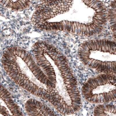 Immunohistochemistry: beta-Catenin Antibody (CL3689) [NBP2-61628] - Staining of human endometrium shows strong membranous immunoreactivity in glandular epithelium.