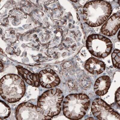 Immunohistochemistry: beta-Catenin Antibody (CL3689) [NBP2-61628] - Staining of human kidney shows strong membranous positivity in renal tubules and glomerulus cells.