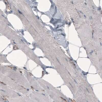 Immunohistochemistry-Paraffin: beta-Catenin Antibody (CL3689) [NBP2-61628] - Staining of human skeletal muscle shows absence of immunoreactivity in muscle fibers  (negative control).