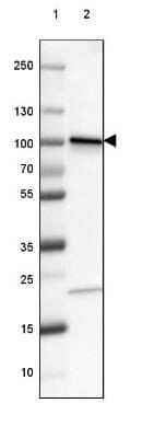 Western Blot: beta-Catenin Antibody (CL3689) [NBP2-61628] - Lane 1: Marker [kDa] 250, 130, 100, 70, 55, 35, 25, 15, 10Lane 2: Human cell line A-549
