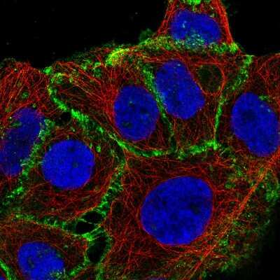 Immunocytochemistry/Immunofluorescence: beta-Catenin Antibody (CL3691) [NBP2-61629] - Staining of A-431 cells using the Anti-CTNNB1 monoclonal antibody, showing specific staining in the plasma membrane in green. Microtubule- and nuclear probes are visualized in red and blue, respectively (where available).