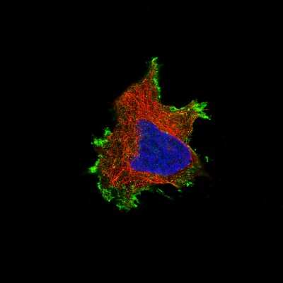 Immunocytochemistry/Immunofluorescence: beta-Catenin Antibody (CL3691) [NBP2-61629] - Staining of U-251 cells using the Anti-CTNNB1 monoclonal antibody, showing specific staining in the plasma membrane in green. Microtubule- and nuclear probes are visualized in red and blue, respectively (where available).