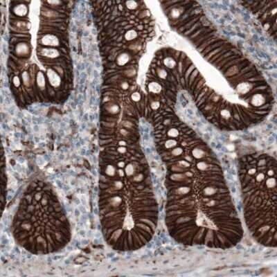 Immunohistochemistry: beta-Catenin Antibody (CL3691) [NBP2-61629] - Staining of human small intestine shows strong membranous immunoreactivity in the epithelial cells.