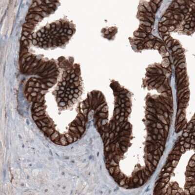 Immunohistochemistry: beta-Catenin Antibody (CL3691) [NBP2-61629] - Staining of human prostate shows membranous immunoreactivity in epithelial cells.