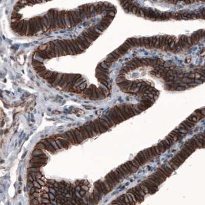 Immunohistochemistry: beta-Catenin Antibody (CL3691) [NBP2-61629] - Staining of human fallopian tube shows strong membranous immunoreactivity in epithelial cells.