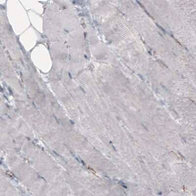 Immunohistochemistry-Paraffin: beta-Catenin Antibody (CL3691) [NBP2-61629] - Staining of human skeletal muscle shows absence of immunoreactivity in muscle fibers  (negative control).