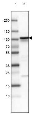 Western Blot: beta-Catenin Antibody (CL3691) [NBP2-61629] - Lane 1: Marker [kDa] 250, 130, 100, 70, 55, 35, 25, 15, 10Lane 2: Human cell line SK-MEL-30