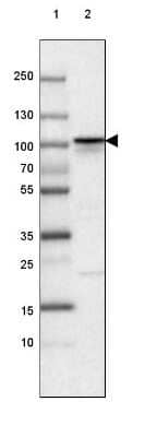 Western Blot: beta-Catenin Antibody (CL3691) [NBP2-61629] - Lane 1: Marker [kDa] 250, 130, 100, 70, 55, 35, 25, 15, 10Lane 2: Human cell line A-549
