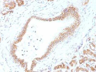 Immunohistochemistry-Paraffin: beta-Catenin Antibody (CTNNB1/1507) - Azide and BSA Free [NBP2-54542] - beta-Catenin Antibody (CTNNB1/1507) [NBP2-54542] - Formalin-fixed, paraffin-embedded human Pancreas stained with Beta-Catenin Monoclonal Antibody (CTNNB1/1507).