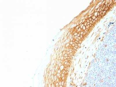 Immunohistochemistry-Paraffin: beta-Catenin Antibody (CTNNB1/1507) - Azide and BSA Free [NBP2-54542] - beta-Catenin Antibody (CTNNB1/1507) [NBP2-54542] - Formalin-fixed, paraffin-embedded human Tonsil stained with Beta-Catenin Monoclonal Antibody (CTNNB1/1507).