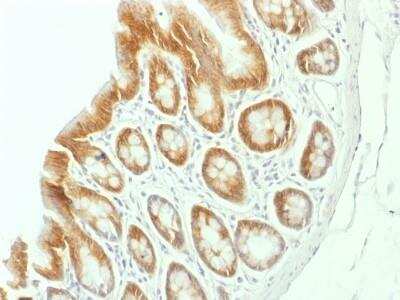 Immunohistochemistry-Paraffin: beta-Catenin Antibody (CTNNB1/1507) - Azide and BSA Free [NBP2-54542] - beta-Catenin Antibody (CTNNB1/1507) [NBP2-54542] - Formalin-fixed, paraffin-embedded Rat Colon stained with Beta-Catenin Monoclonal Antibody (CTNNB1/1507).