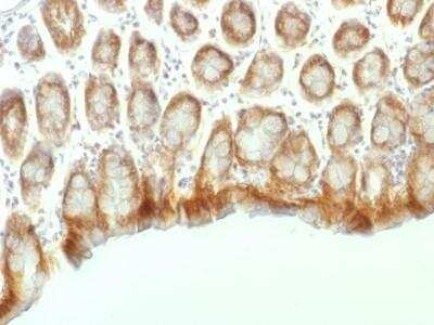Immunohistochemistry-Paraffin: beta-Catenin Antibody (CTNNB1/1507) - Azide and BSA Free [NBP2-54542] - beta-Catenin Antibody (CTNNB1/1507) [NBP2-54542] - Formalin-fixed, paraffin-embedded Mouse Colon stained with Beta-Catenin Monoclonal Antibody (CTNNB1/1507).