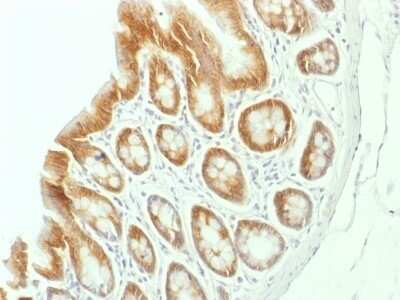 Immunohistochemistry-Paraffin: beta-Catenin Antibody (CTNNB1/1507) [NBP2-53361] - Formalin-fixed, paraffin-embedded Rat Colon stained with Beta-Catenin Monoclonal Antibody (CTNNB1/1507).