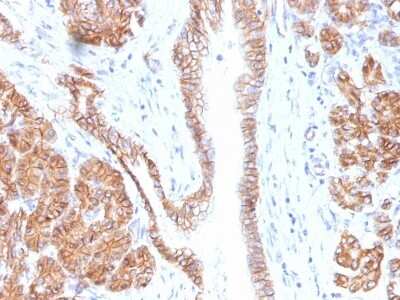Immunohistochemistry-Paraffin: beta-Catenin Antibody (CTNNB1/1508) [NBP2-53365] - Formalin-fixed, paraffin-embedded human Pancreas stained with Beta-Catenin Monoclonal Antibody (CTNNB1/1508).