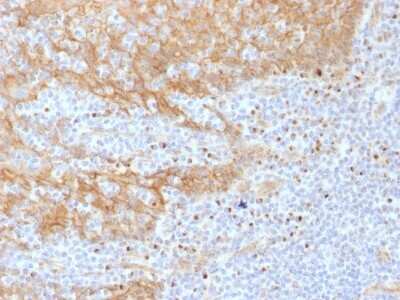 Immunohistochemistry-Paraffin: beta-Catenin Antibody (CTNNB1/1508) [NBP2-53365] - Formalin-fixed, paraffin-embedded human Tonsil stained with Beta-Catenin Monoclonal Antibody (CTNNB1/1508).