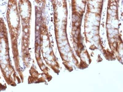 Immunohistochemistry-Paraffin: beta-Catenin Antibody (CTNNB1/1508) [NBP2-53365] - Formalin-fixed, paraffin-embedded Mouse Colon stained with Beta-Catenin Monoclonal Antibody (CTNNB1/1508).
