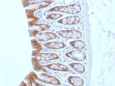 Immunohistochemistry-Paraffin: beta-Catenin Antibody (CTNNB1/1508) [NBP2-53365] - Formalin-fixed, paraffin-embedded Rat Colon stained with Beta-Catenin Monoclonal Antibody (CTNNB1/1508).