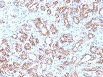 Immunohistochemistry-Paraffin: beta-Catenin Antibody (CTNNB1/1509) - Azide and BSA Free [NBP2-54540] - beta-Catenin Antibody (CTNNB1/1509) [NBP2-54540] - Formalin-fixed, paraffin-embedded human Pancreas stained with Beta-Catenin Monoclonal Antibody (CTNNB1/1509).