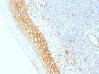 Immunohistochemistry-Paraffin: beta-Catenin Antibody (CTNNB1/1509) - Azide and BSA Free [NBP2-54540] - beta-Catenin Antibody (CTNNB1/1509) [NBP2-54540] - Formalin-fixed, paraffin-embedded human Tonsil stained with Beta-Catenin Monoclonal Antibody (CTNNB1/1509).