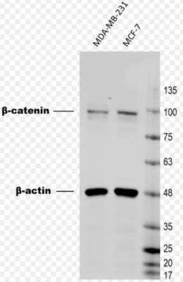 Western Blot: beta-Catenin Antibody (CTNNB1/1509) - Azide and BSA Free [NBP2-54540] - Breast cancer cell lysates were probed with Mouse anti-Human Beta-Catenin antibody (#NBP2-53366-20ug) at 0.5 ug/mL, followed by 1:5,000 anti-Mouse secondary antibody. Image is courtesy of customer review.