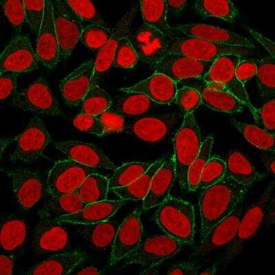 Immunocytochemistry/Immunofluorescence: beta-Catenin Antibody (CTNNB1/2030R) - Azide and BSA Free [NBP2-79888] - Immunofluorescence Analysis of PFA fixed HeLa cells labeling Beta-Catenin with Beta-Catenin Recombinant Rabbit Monoclonal Ab (CTNNB1/2030R followed by Goat anti-Mouse IgG-CF488 (Green). The nuclear counterstain is Reddot (Red).