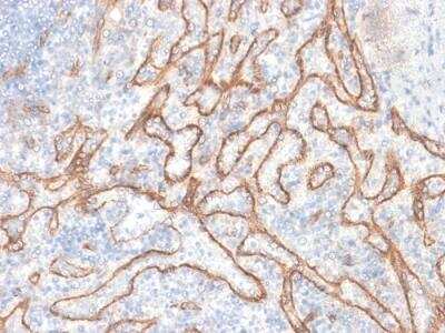 Immunohistochemistry-Paraffin: beta-Catenin Antibody (CTNNB1/2030R) - Azide and BSA Free [NBP2-79888] - Formalin-fixed, paraffin-embedded human Tonsil stained with Beta-Catenin Recombinant Rabbit Monoclonal Antibody (CTNNB1/2030R).