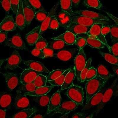 Immunocytochemistry/Immunofluorescence: beta-Catenin Antibody (CTNNB1/2030R) [NBP2-79753] - Immunofluorescence Analysis of HeLa cells labeling Beta-Catenin with beta-Catenin Antibody (CTNNB1/2030R) followed by Goat anti-Mouse IgG-CF488 (Green). The nuclear counterstain is RedDot (Red)