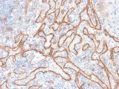 Immunohistochemistry-Paraffin: beta-Catenin Antibody (CTNNB1/2030R) [NBP2-79753] - Formalin-fixed, paraffin-embedded human Tonsil stained with beta-Catenin Antibody (CTNNB1/2030R).