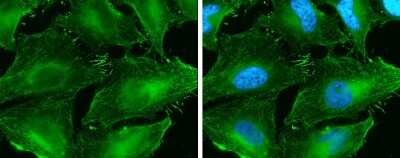 <b>Genetic Strategies Validation. </b>Immunocytochemistry/Immunofluorescence: beta-Catenin Antibody (GT2169) [NBP3-13530] - beta-Catenin antibody [GT2169] detects beta-Catenin protein at cell membrane by immunofluorescent analysis. Sample: HeLa cells were fixed in 4% paraformaldehyde at RT for 15 min. Green: beta-Catenin protein stained by beta-Catenin antibody [GT2169] (NBP3-13530) diluted at 1:200. Blue: Hoechst 33342 staining.