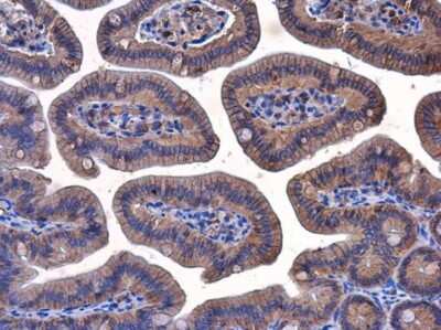 Immunohistochemistry-Paraffin: beta-Catenin Antibody (GT2169) [NBP3-13530] - beta-Catenin antibody [GT2169] detects beta-Catenin protein at cell membrane and cytoplasm in mouse intestine by immunohistochemical analysis. Sample: Paraffin-embedded mouse intestine. beta-Catenin antibody [GT2169] (NBP3-13530) diluted at 1:200. Antigen Retrieval: Citrate buffer, pH 6.0, 15 min