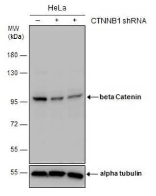 Western Blot: beta-Catenin Antibody (GT2169) [NBP3-13530] - Non-transfected (-) and transfected (+) HeLa whole cell extracts (30 ug) were separated by 7.5% SDS-PAGE, and the membrane was blotted with beta-Catenin antibody [GT2169] (NBP3-13530) diluted at 1:500.