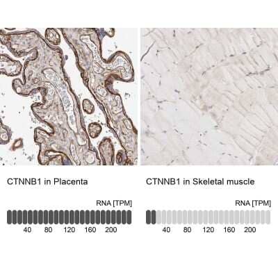 <b>Orthogonal Strategies Validation. </b>Immunohistochemistry-Paraffin: beta-Catenin Antibody [NBP1-89990] - Staining in human placenta and skeletal muscle tissues using anti-CTNNB1 antibody. Corresponding CTNNB1 RNA-seq data are presented for the same tissues.