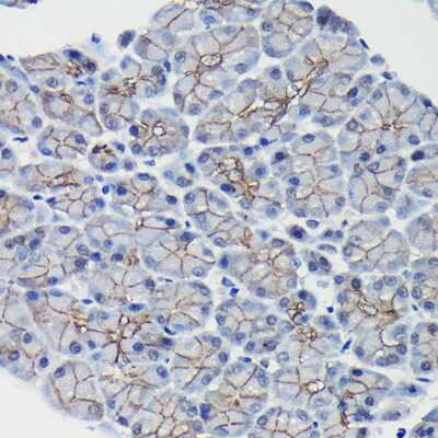Immunohistochemistry-Paraffin: beta-Catenin Antibody [NBP2-92970] - Immunohistochemistry of paraffin-embedded rat pancreas using [KO Validated] beta-Catenin Rabbit pAb (NBP2-92970) at dilution of 1:100 (40x lens). Perform high pressure antigen retrieval with 10 mM citrate buffer pH 6.0 before commencing with IHC staining protocol.