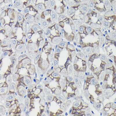 Immunohistochemistry-Paraffin: beta-Catenin Antibody [NBP2-92970] - Immunohistochemistry of paraffin-embedded mouse stomach using [KO Validated] beta-Catenin Rabbit pAb (NBP2-92970) at dilution of 1:100 (40x lens). Perform high pressure antigen retrieval with 10 mM citrate buffer pH 6.0 before commencing with IHC staining protocol.
