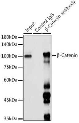 Immunoprecipitation: beta-Catenin Antibody [NBP2-92970] - Immunoprecipitation analysis of 300ug extracts of 293T cells using 3ug beta-Catenin antibody (NBP2-92970). Western blot was performed from the immunoprecipitate using beta-Catenin antibody (NBP2-92970) at a dilution of 1:1000.