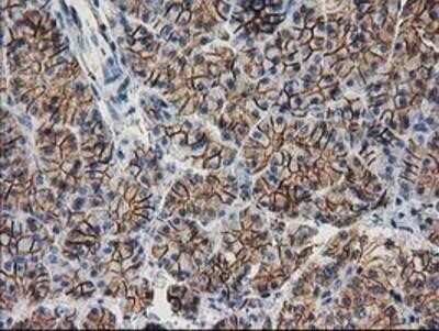 Immunohistochemistry: beta-Catenin Antibody (OTI12H7) - Azide and BSA Free [NBP2-70509] - Staining of paraffin-embedded Human pancreas tissue using anti-beta Catenin mouse monoclonal antibody.