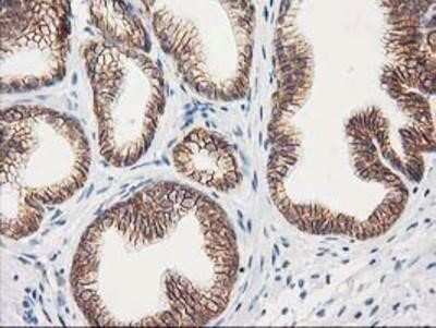 Immunohistochemistry: beta-Catenin Antibody (OTI12H7) - Azide and BSA Free [NBP2-70509] - Staining of paraffin-embedded Human prostate tissue using anti-beta Catenin mouse monoclonal antibody.