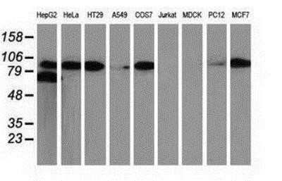 Western Blot: beta-Catenin Antibody (OTI12H7) - Azide and BSA Free [NBP2-70509] - Analysis of extracts (35ug) from 9 different cell lines by using anti-beta Catenin monoclonal antibody.