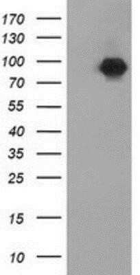 Western Blot: beta-Catenin Antibody (OTI12H7) - Azide and BSA Free [NBP2-70509] - HEK293T cells were transfected with the pCMV6-ENTRY control (Left lane) or pCMV6-ENTRY beta Catenin (Right lane) cDNA for 48 hrs and lysed. Equivalent amounts of cell lysates (5 ug per lane) were separated by SDS-PAGE and immunoblotted with anti-beta Cate